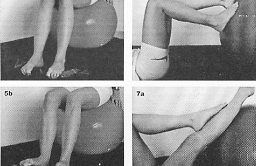 Cvičenia pre pacientov s plochými nohami